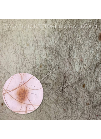 Изображение галлереи