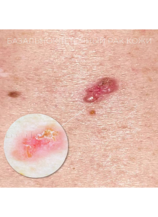 Изображение галлереи