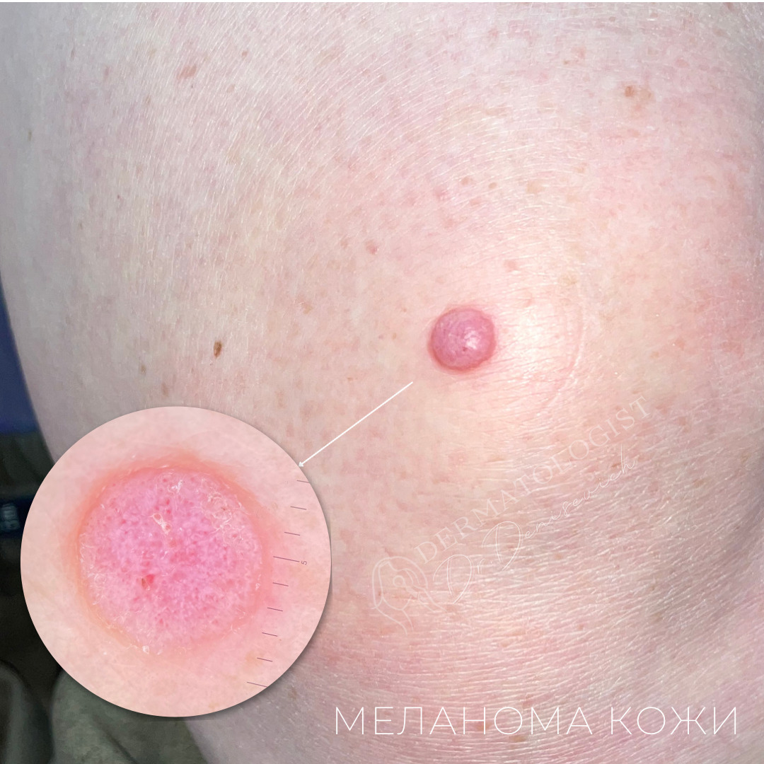 Изображение галлереи