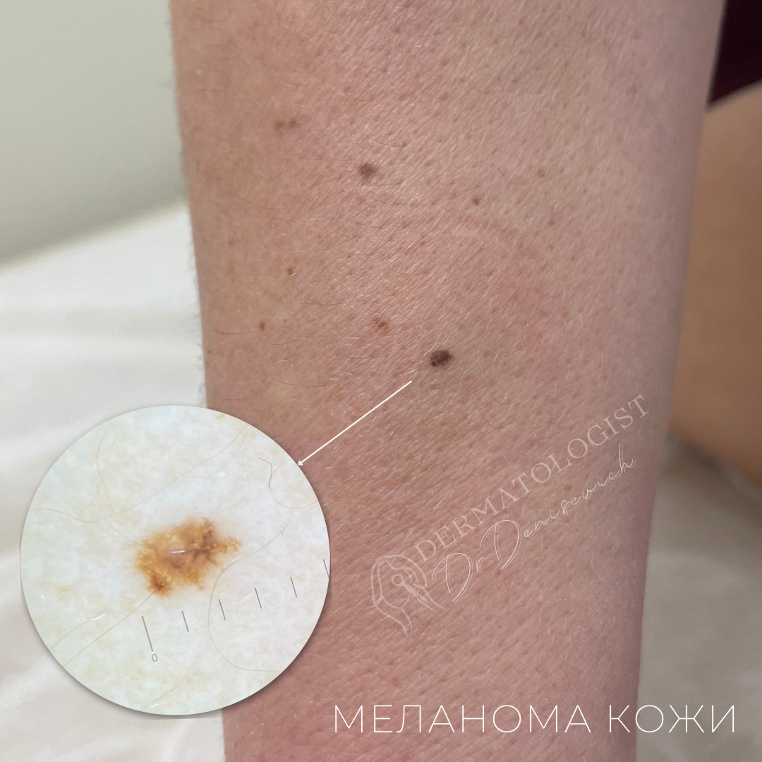 Изображение галлереи