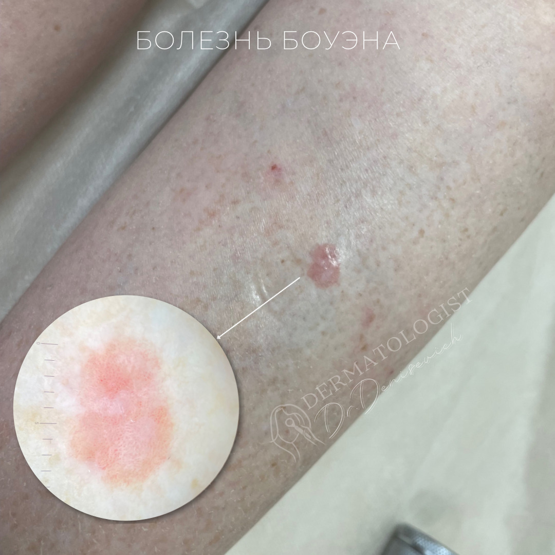 Изображение галлереи