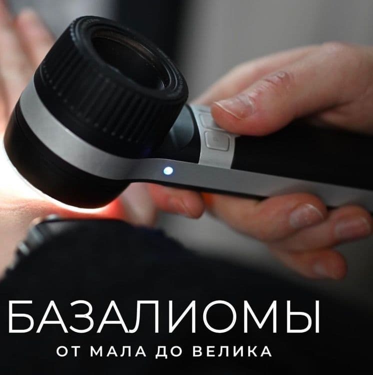 Базальноклеточный рак кожи: от мала до велика